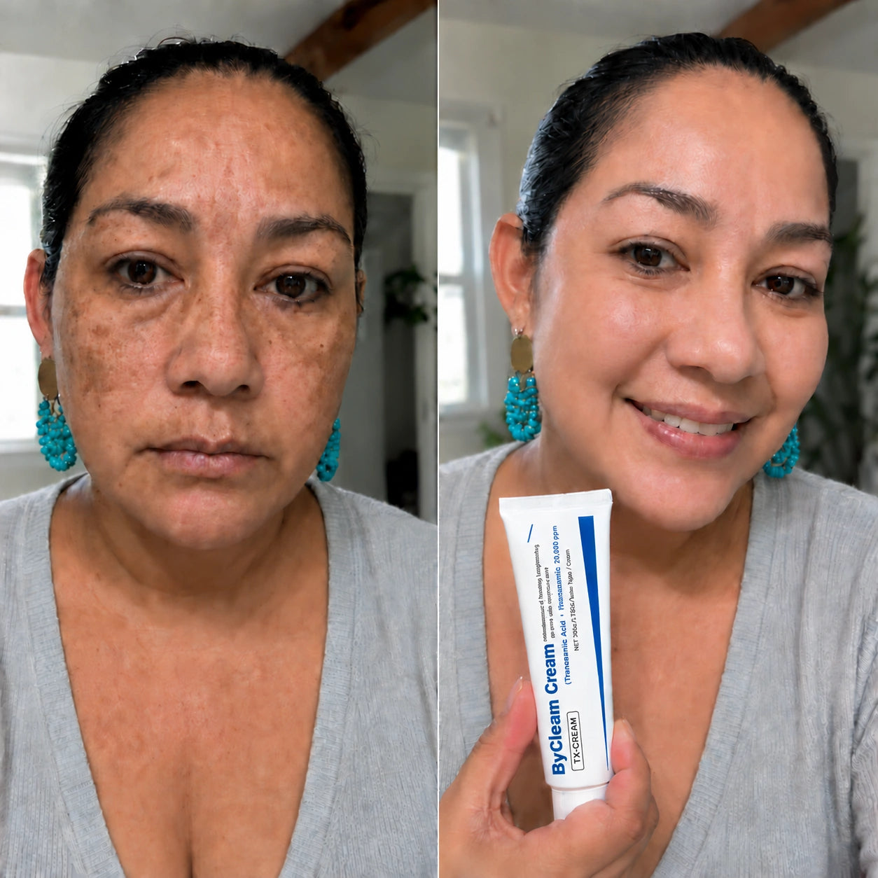 ByClean Cream — corrector de manchas