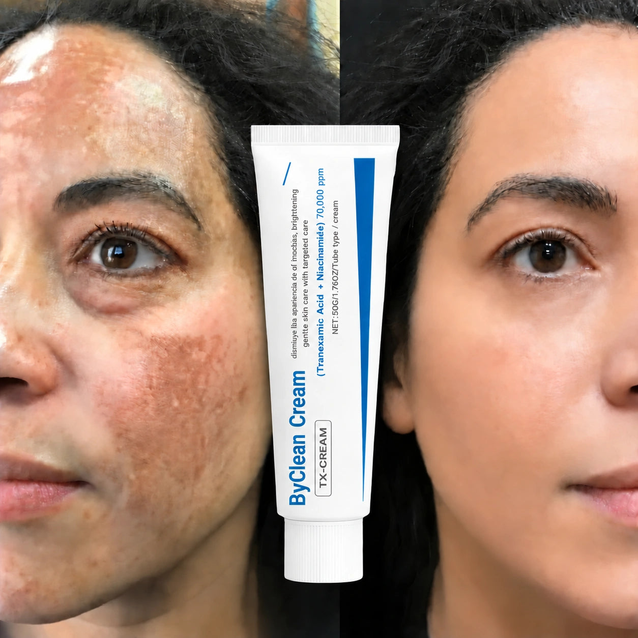 ByClean Cream® Corrector de Manchas