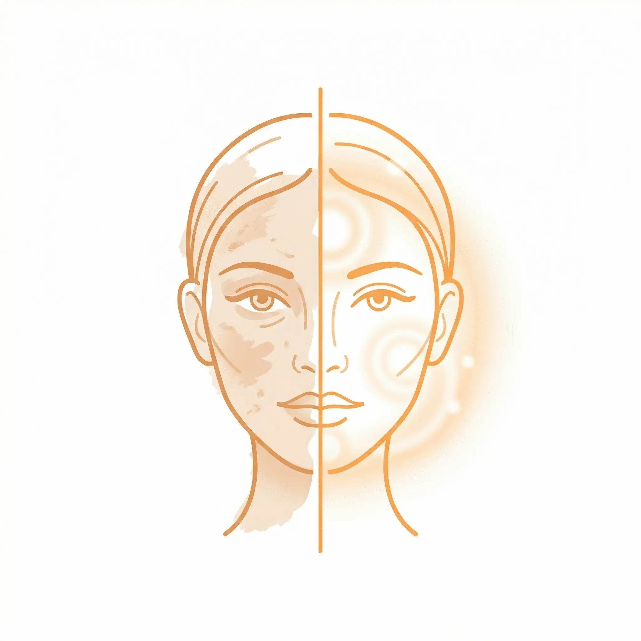 ByClean Cream — corrector de manchas
