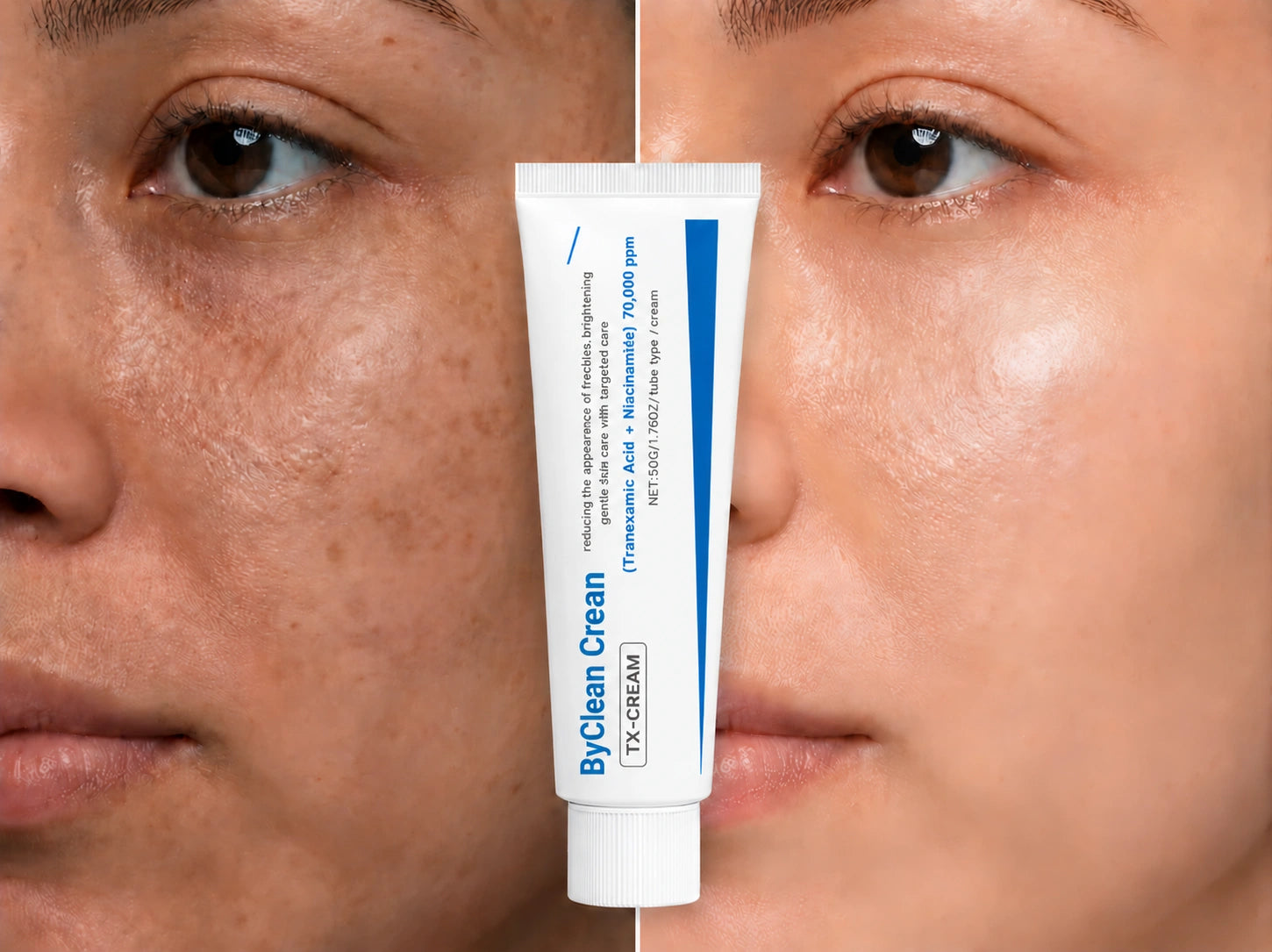 ByClean Cream — corrector de manchas