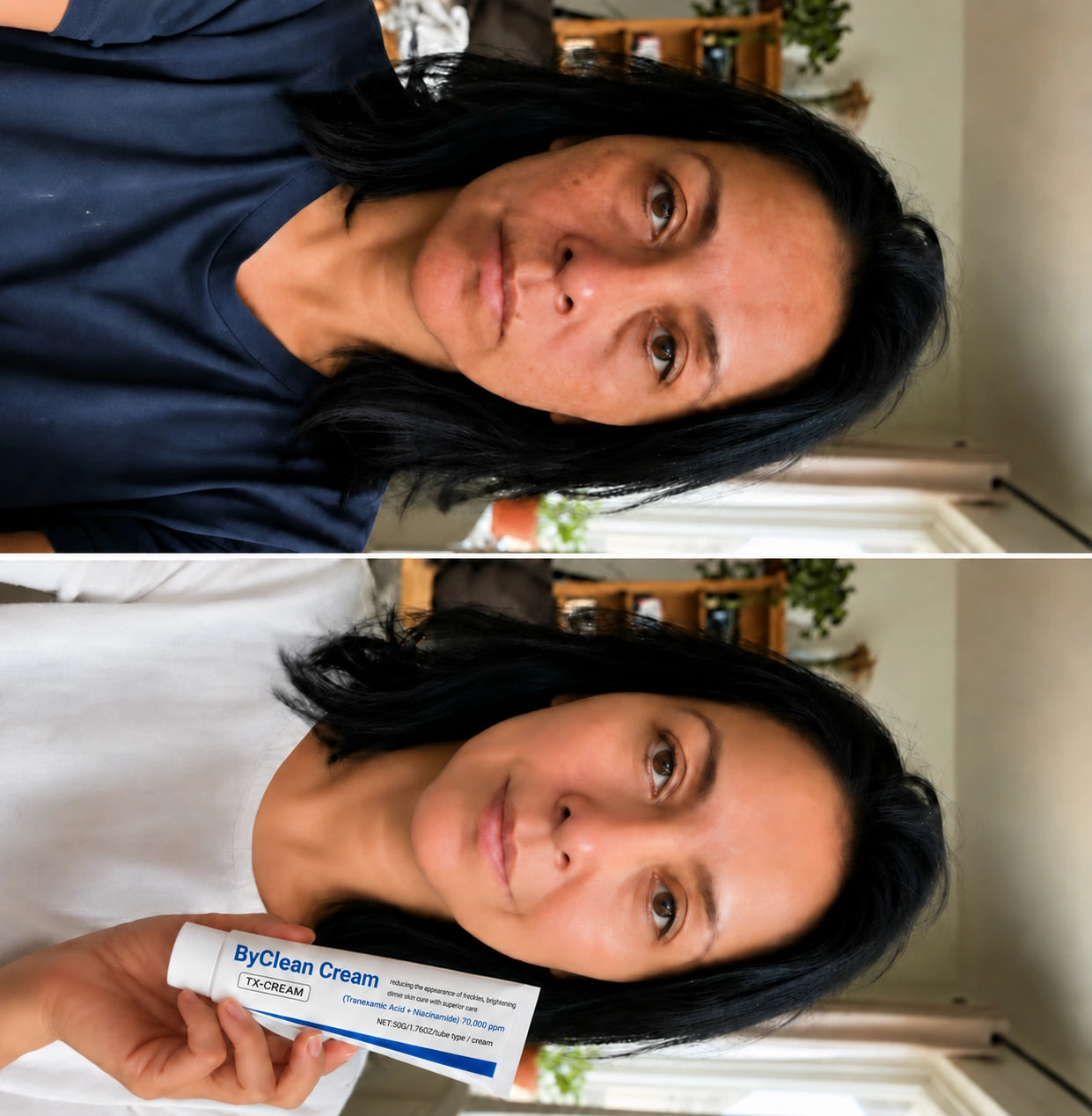 ByClean Cream — corrector de manchas